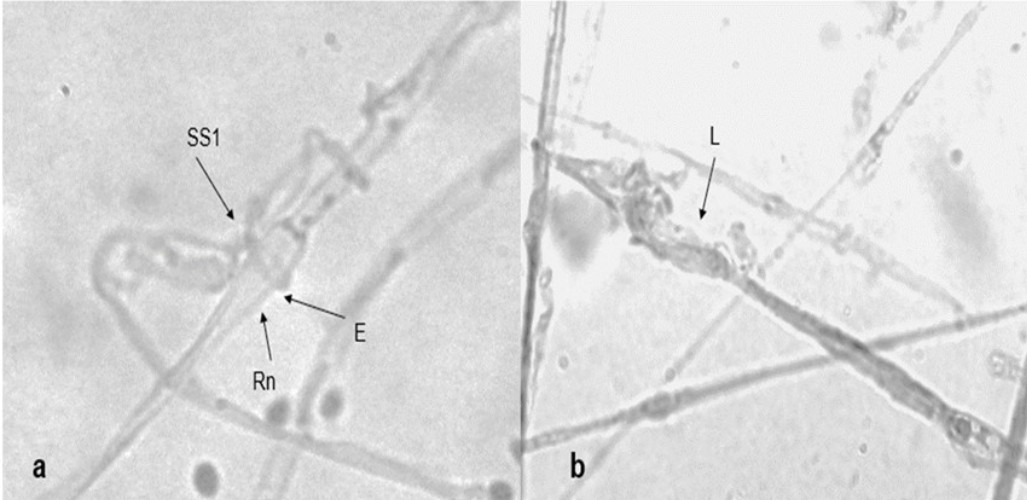 Micopararitismo de T. tometosum en el patógeno