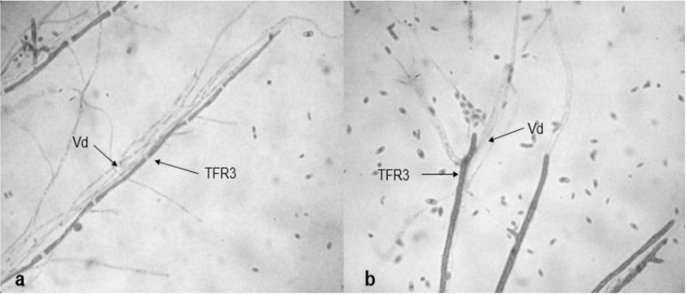 Micoparasitismo T.asperellum